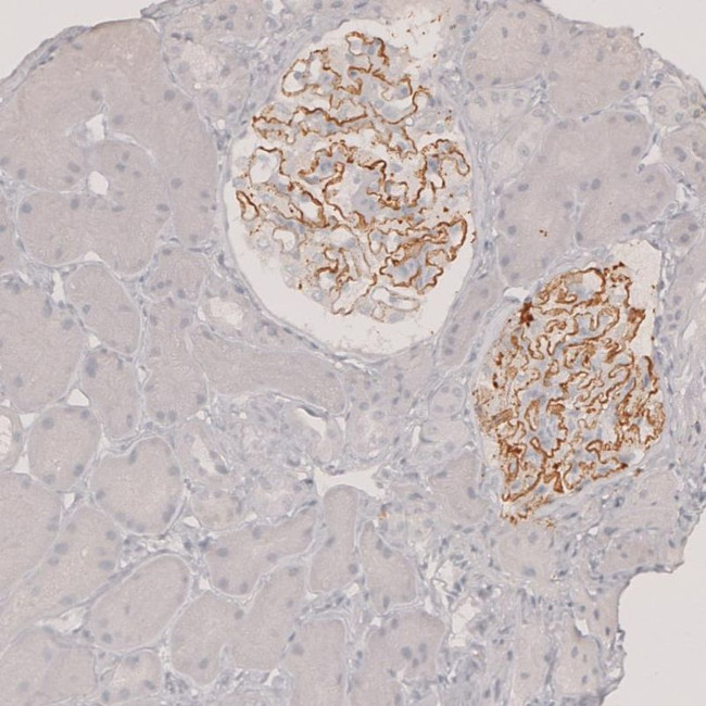 PLA2R1 Antibody in Immunohistochemistry (IHC)