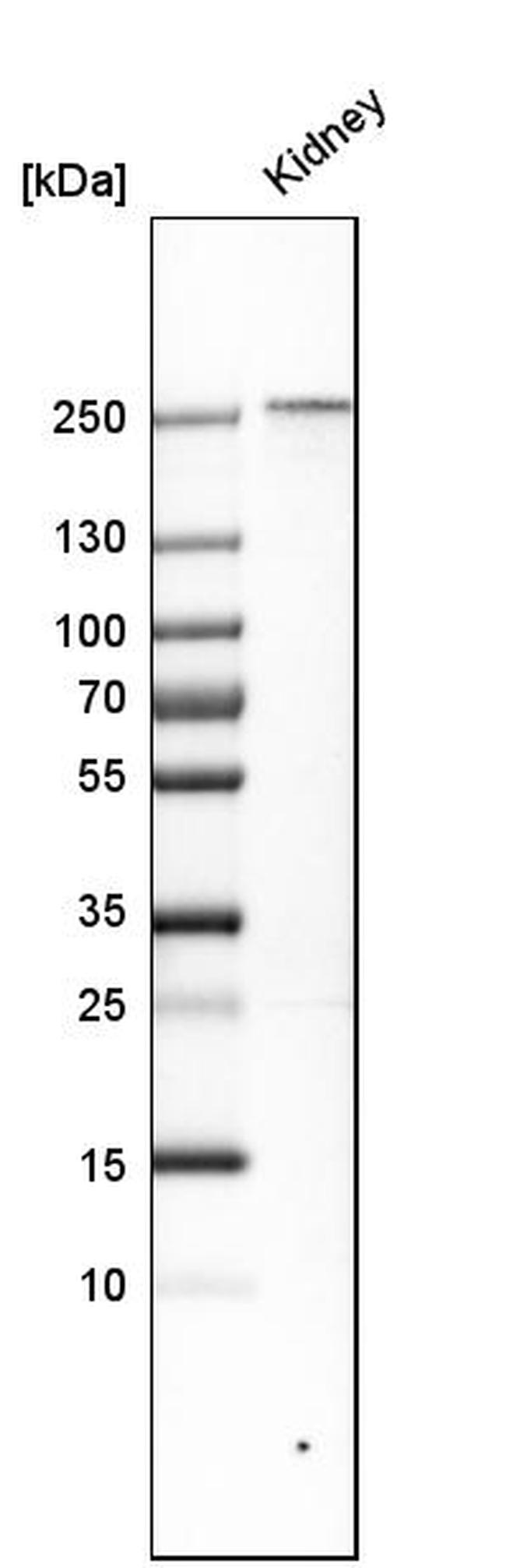 PLA2R1 Antibody in Western Blot (WB)