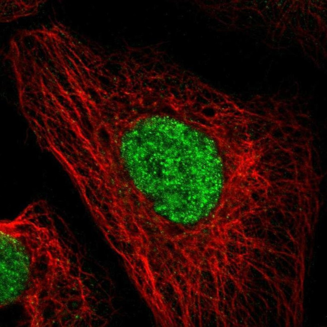 DACH1 Antibody in Immunocytochemistry (ICC/IF)