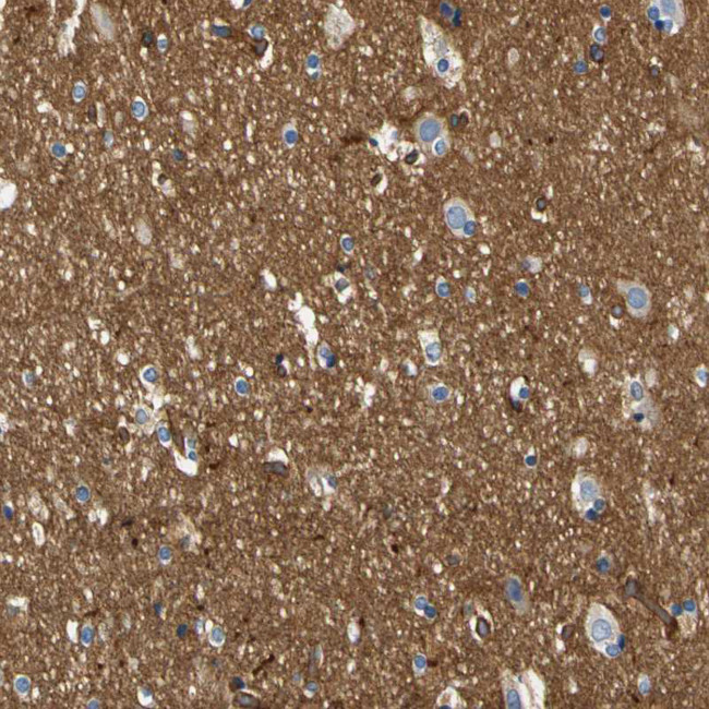 SPTBN1 Antibody in Immunohistochemistry (IHC)