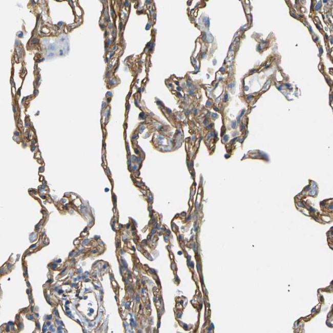 SPTBN1 Antibody in Immunohistochemistry (IHC)