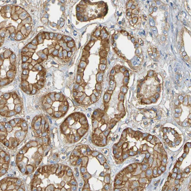 SPTBN1 Antibody in Immunohistochemistry (IHC)