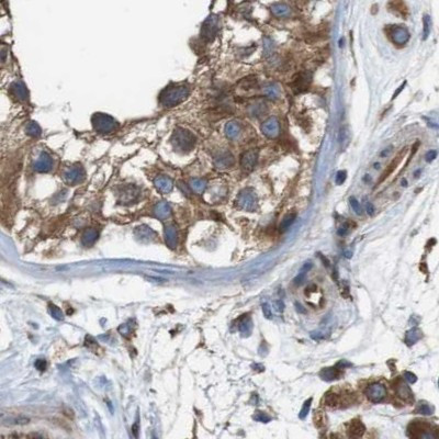 UGGT1 Antibody in Immunohistochemistry (IHC)