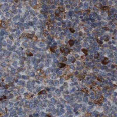 UGGT1 Antibody in Immunohistochemistry (IHC)