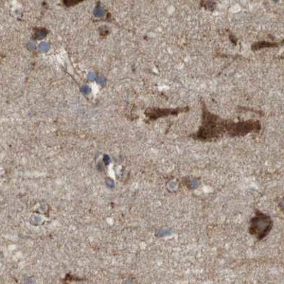 UGGT1 Antibody in Immunohistochemistry (IHC)