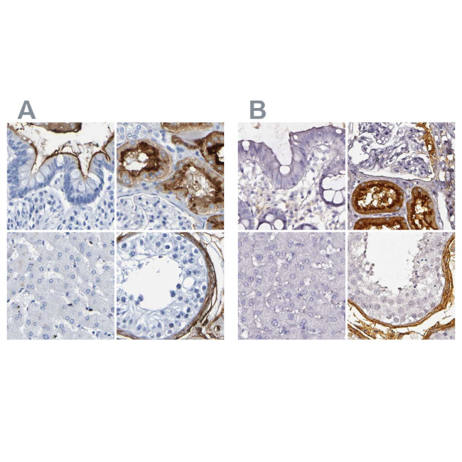 DPEP1 Antibody in Immunohistochemistry (IHC)