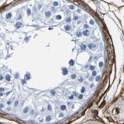 DPEP1 Antibody in Immunohistochemistry (IHC)