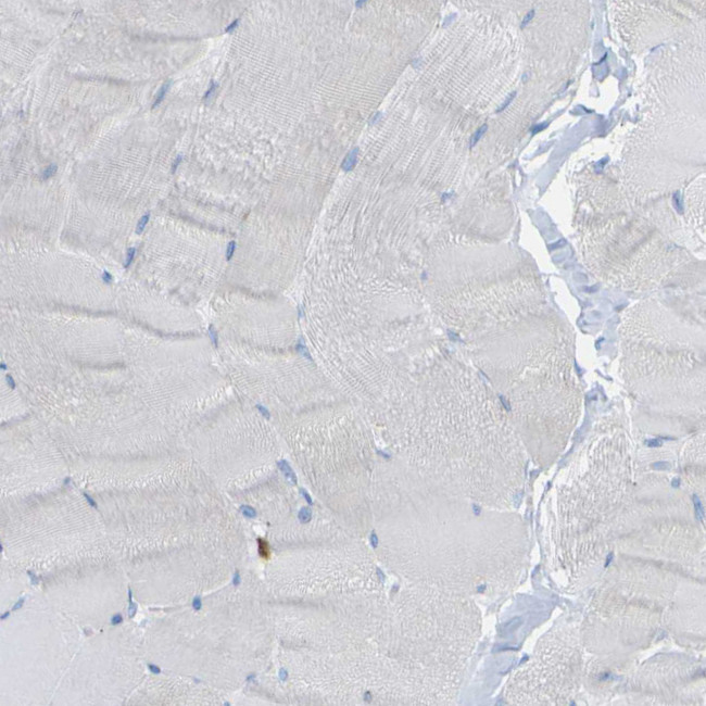 PLD3 Antibody in Immunohistochemistry (IHC)