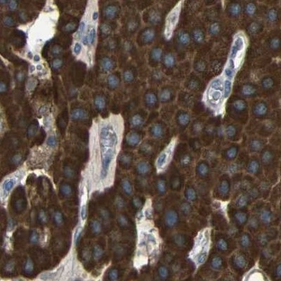 C1GALT1 Antibody in Immunohistochemistry (IHC)