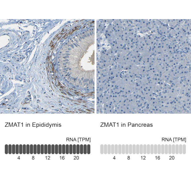 ZMAT1 Antibody in Immunohistochemistry (IHC)