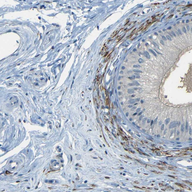 ZMAT1 Antibody in Immunohistochemistry (IHC)