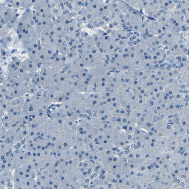 ZMAT1 Antibody in Immunohistochemistry (IHC)