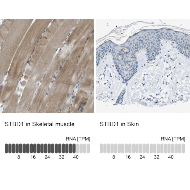 STBD1 Antibody in Immunohistochemistry (IHC)