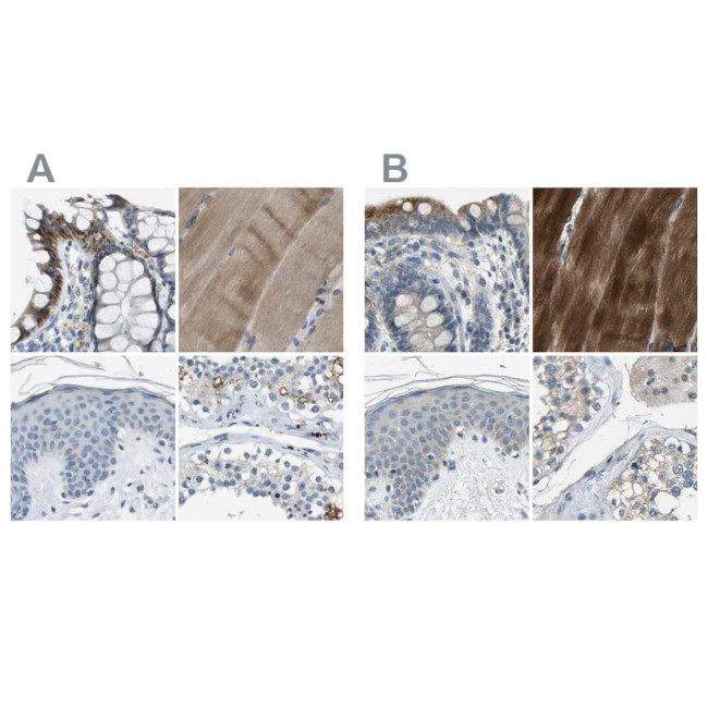 STBD1 Antibody in Immunohistochemistry (IHC)