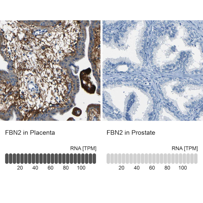 Fibrillin 2 Antibody in Immunohistochemistry (IHC)