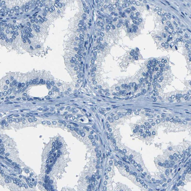 Fibrillin 2 Antibody in Immunohistochemistry (IHC)