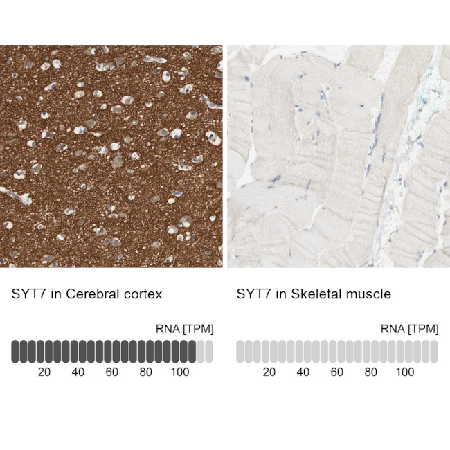 Synaptotagmin 7 Antibody in Immunohistochemistry (IHC)