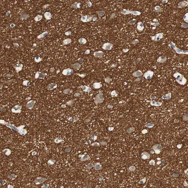 Synaptotagmin 7 Antibody in Immunohistochemistry (IHC)