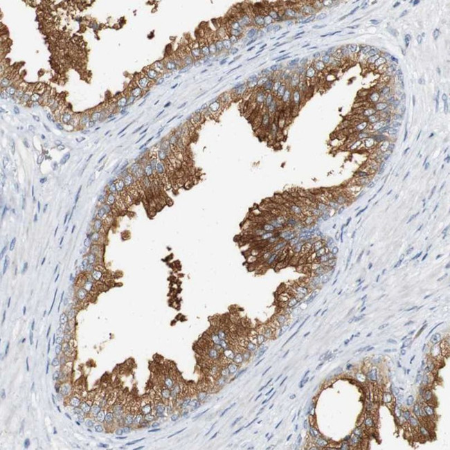 Synaptotagmin 7 Antibody in Immunohistochemistry (IHC)