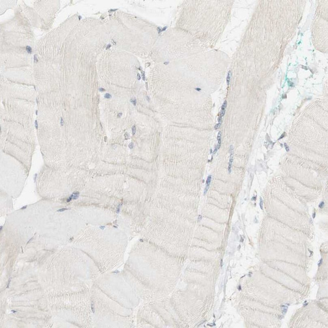 Synaptotagmin 7 Antibody in Immunohistochemistry (IHC)