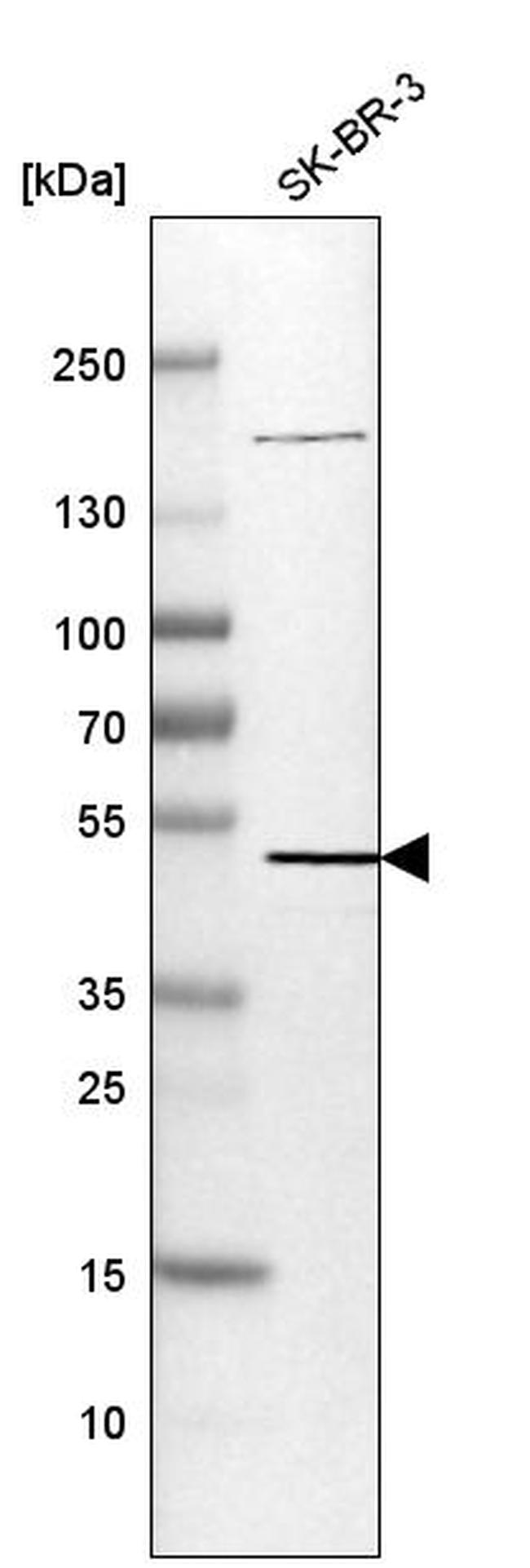 Synaptotagmin 7 Antibody in Western Blot (WB)