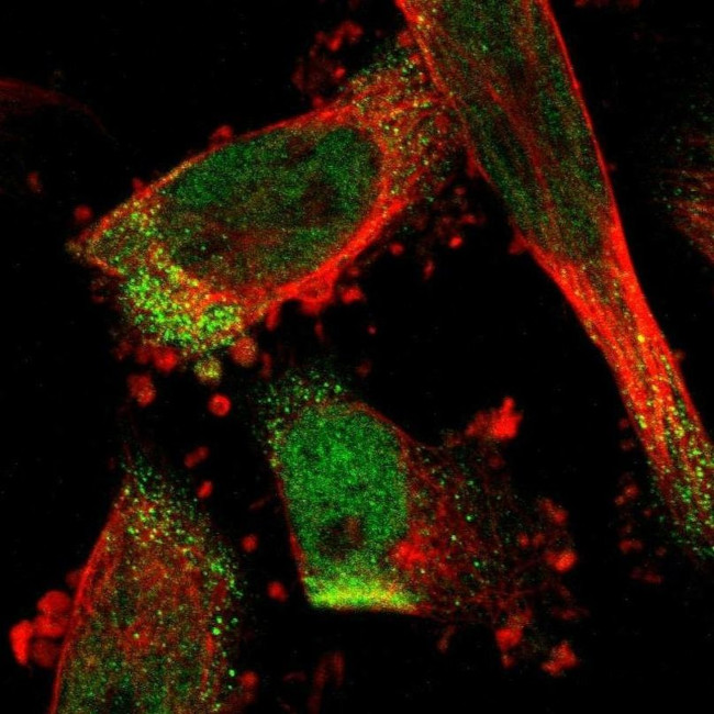 C17orf80 Antibody in Immunocytochemistry (ICC/IF)