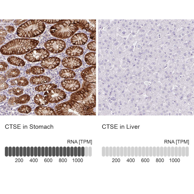 Cathepsin E Antibody in Immunohistochemistry (IHC)