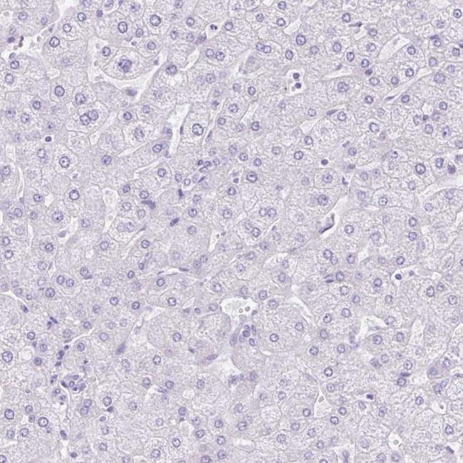 Cathepsin E Antibody in Immunohistochemistry (IHC)