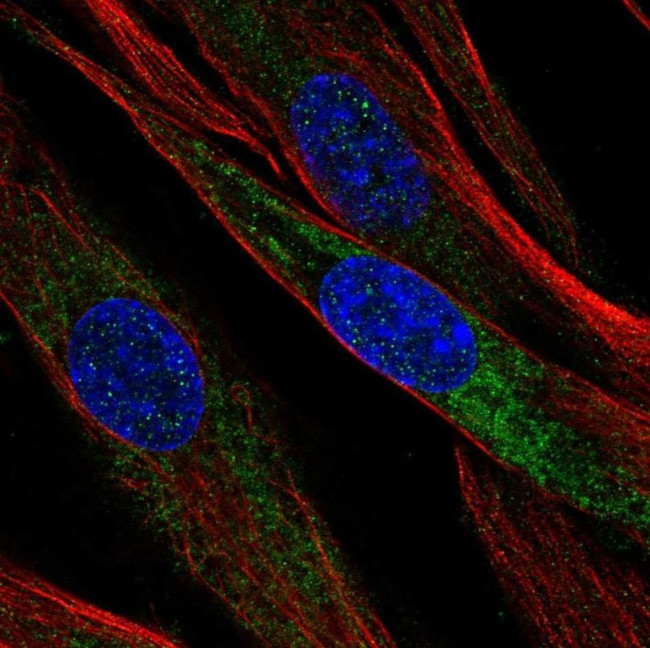 Mimecan Antibody in Immunocytochemistry (ICC/IF)