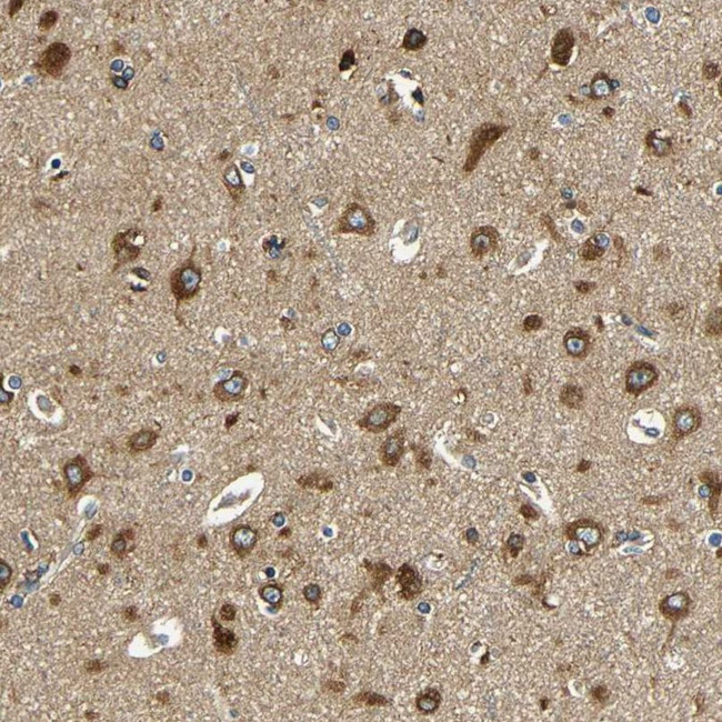 VAPB Antibody in Immunohistochemistry (IHC)