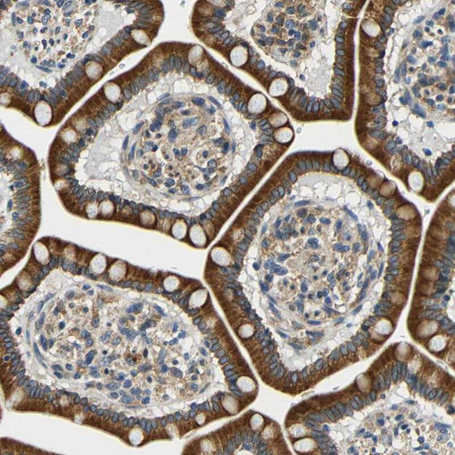 VAPB Antibody in Immunohistochemistry (IHC)