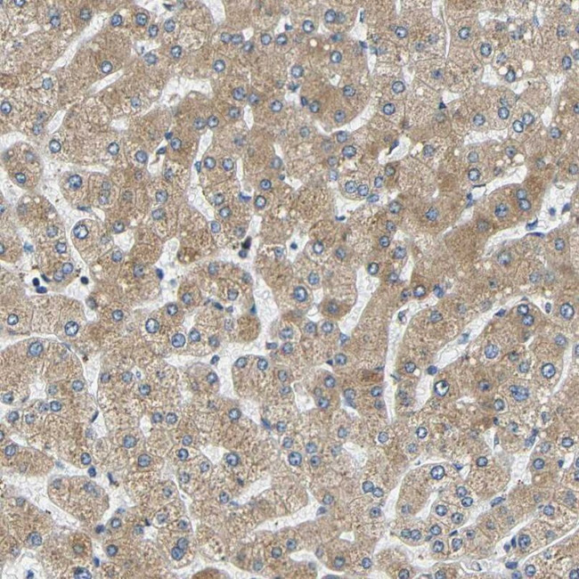 VAPB Antibody in Immunohistochemistry (IHC)