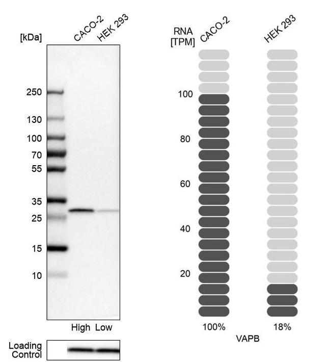 VAPB Antibody in Western Blot (WB)