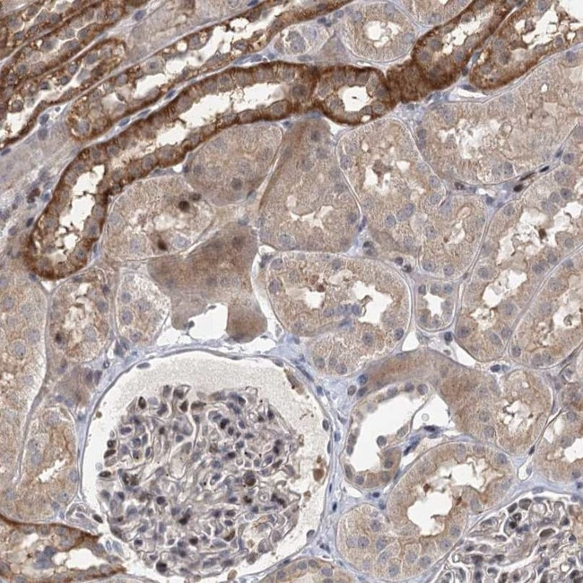 IL11RA Antibody in Immunohistochemistry (IHC)