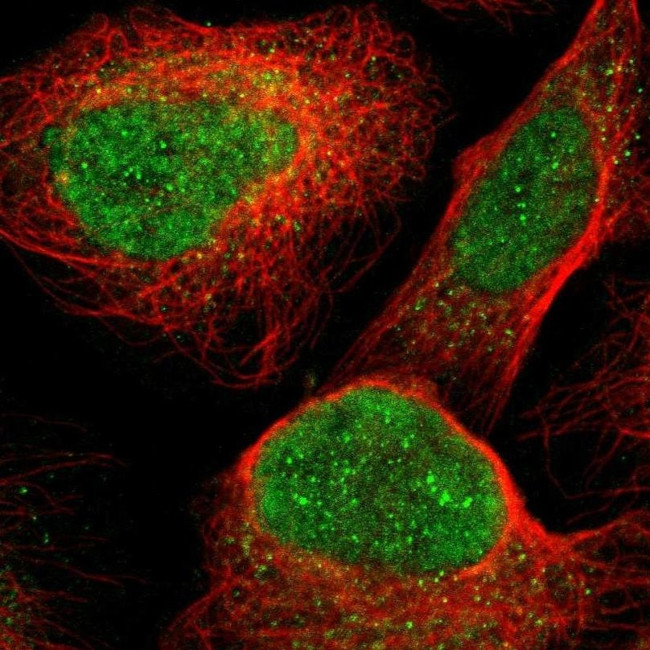 PCOLCE2 Antibody in Immunocytochemistry (ICC/IF)