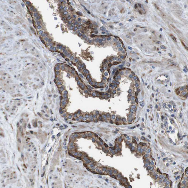 PCOLCE2 Antibody in Immunohistochemistry (IHC)