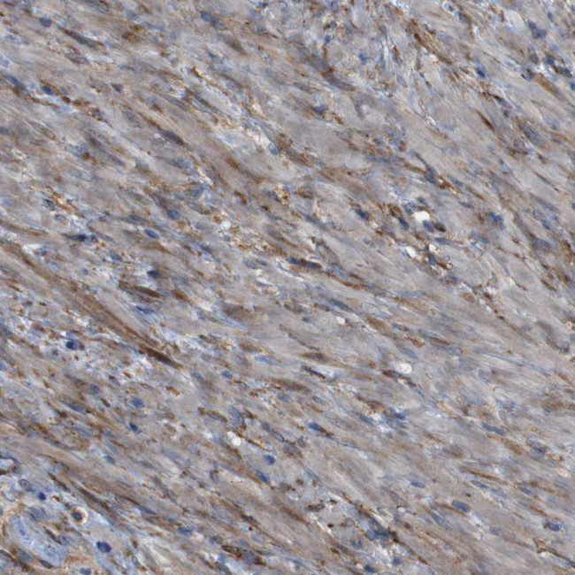 PCOLCE2 Antibody in Immunohistochemistry (IHC)