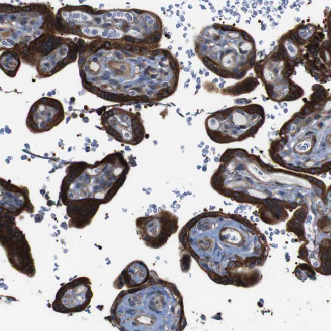 PCOLCE2 Antibody in Immunohistochemistry (IHC)