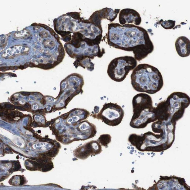 PCOLCE2 Antibody in Immunohistochemistry (IHC)