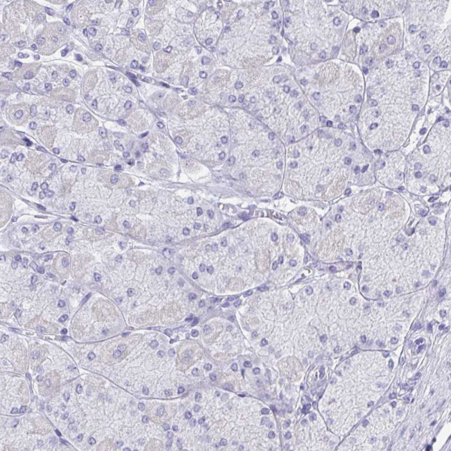 SLC6A1 Antibody in Immunohistochemistry (IHC)