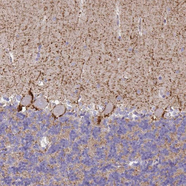 SLC6A1 Antibody in Immunohistochemistry (IHC)