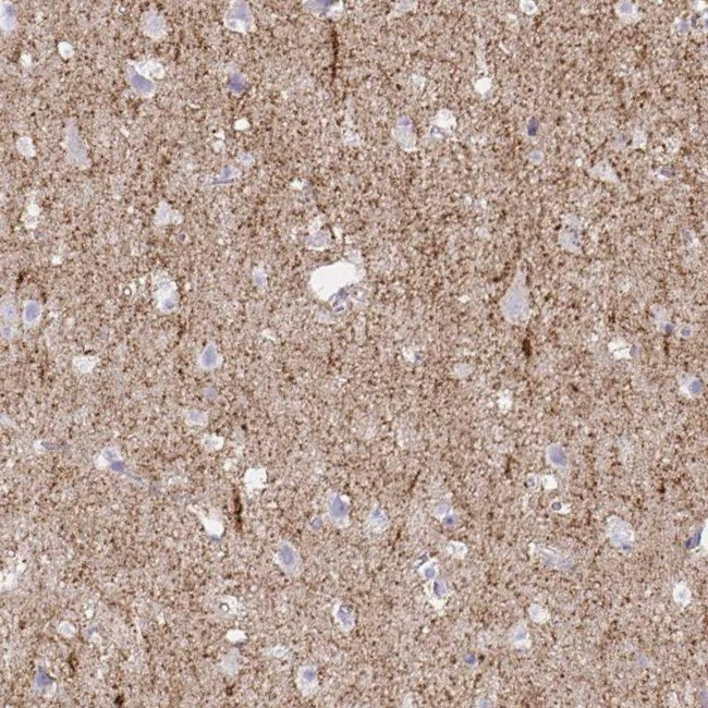 SLC6A1 Antibody in Immunohistochemistry (IHC)