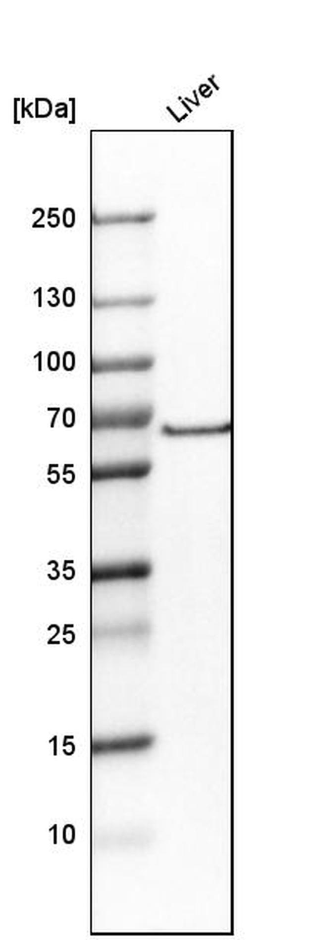 SLC6A1 Antibody in Western Blot (WB)