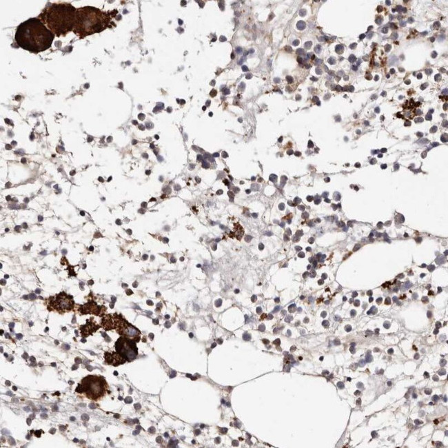 PTPN22 Antibody in Immunohistochemistry (IHC)