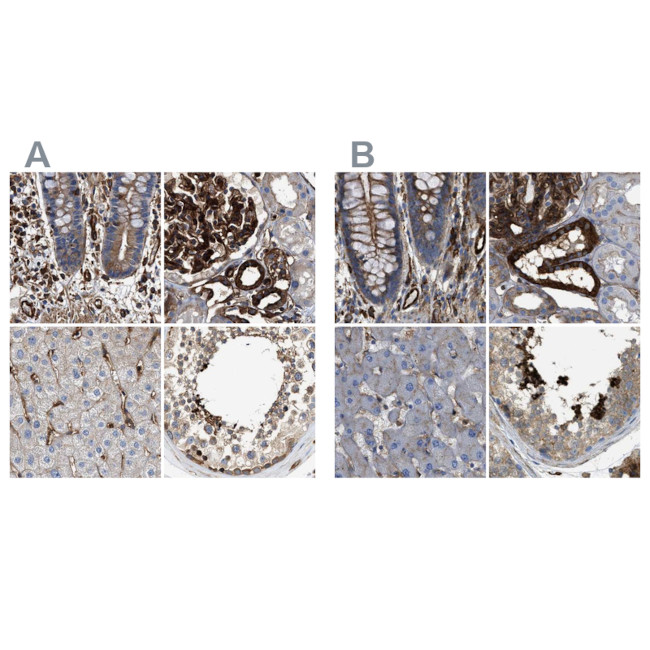 HIP1 Antibody in Immunohistochemistry (IHC)