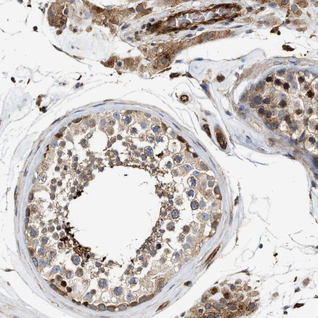 HIP1 Antibody in Immunohistochemistry (IHC)