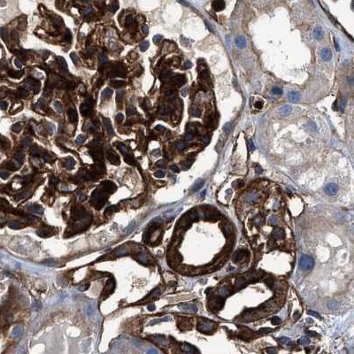 HIP1 Antibody in Immunohistochemistry (IHC)