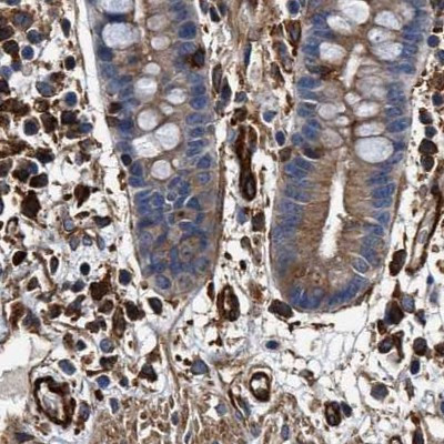 HIP1 Antibody in Immunohistochemistry (IHC)