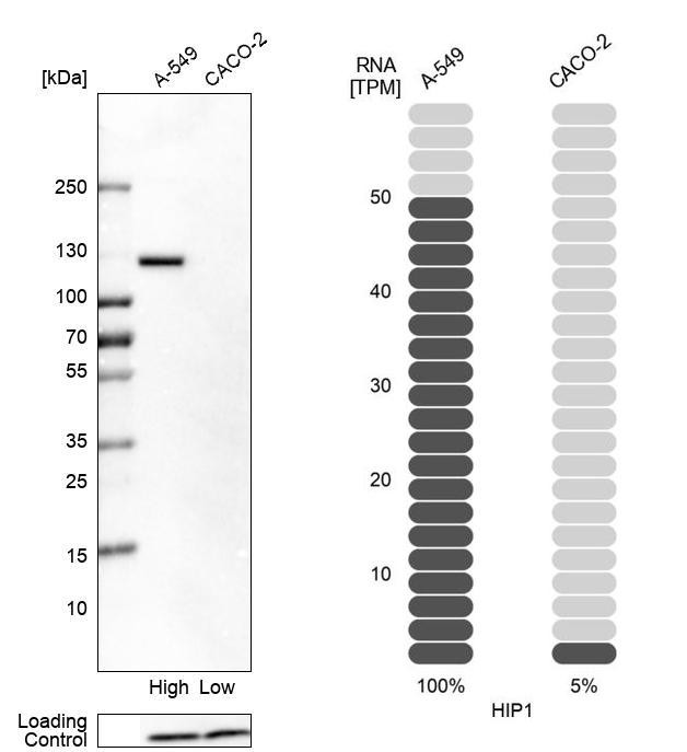 HIP1 Antibody