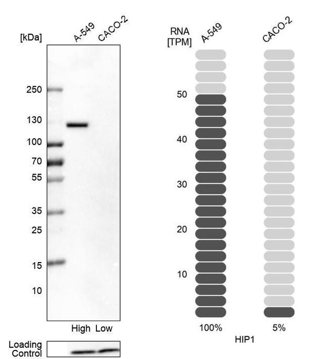 HIP1 Antibody in Western Blot (WB)